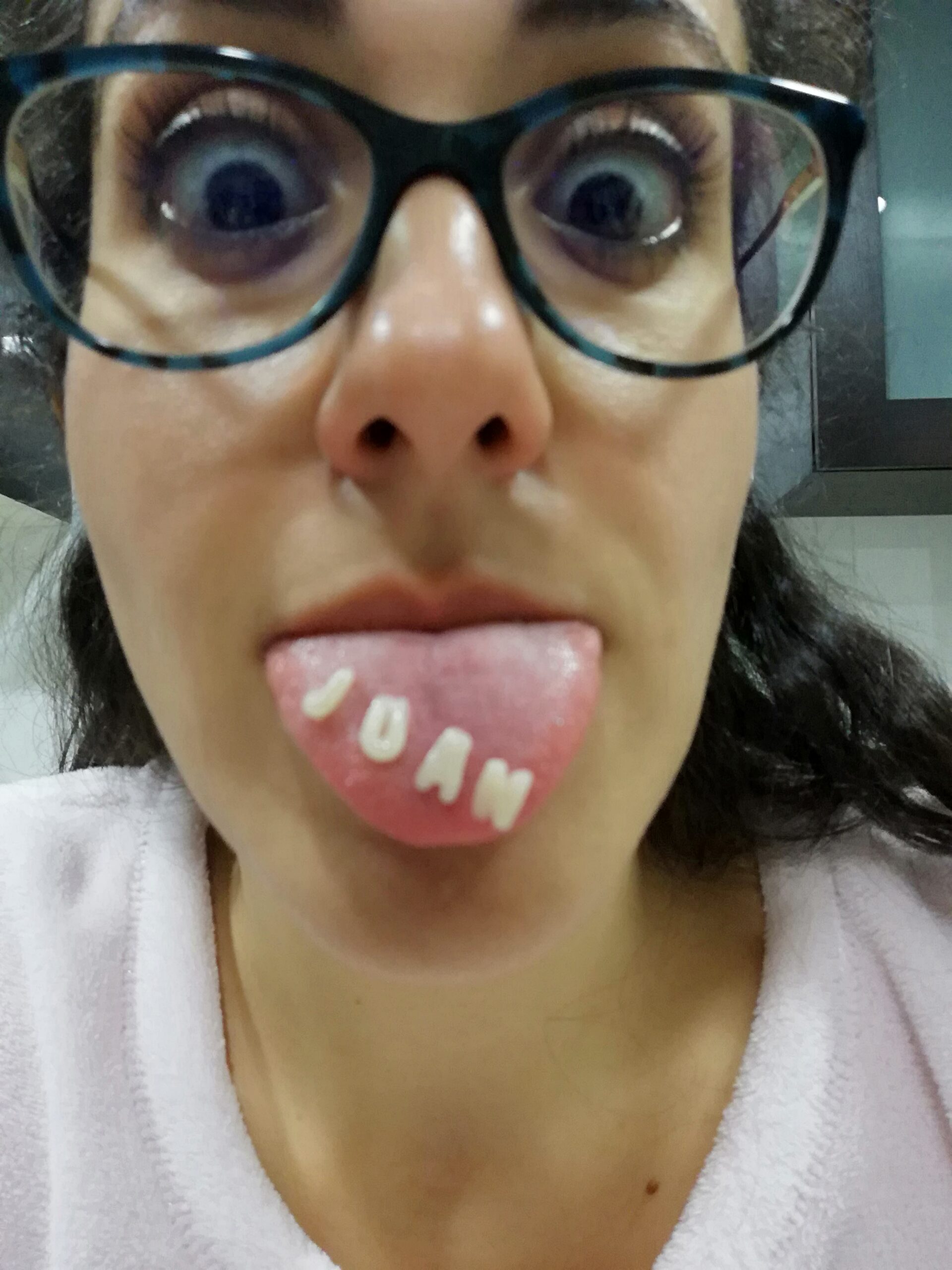 fbt fbt